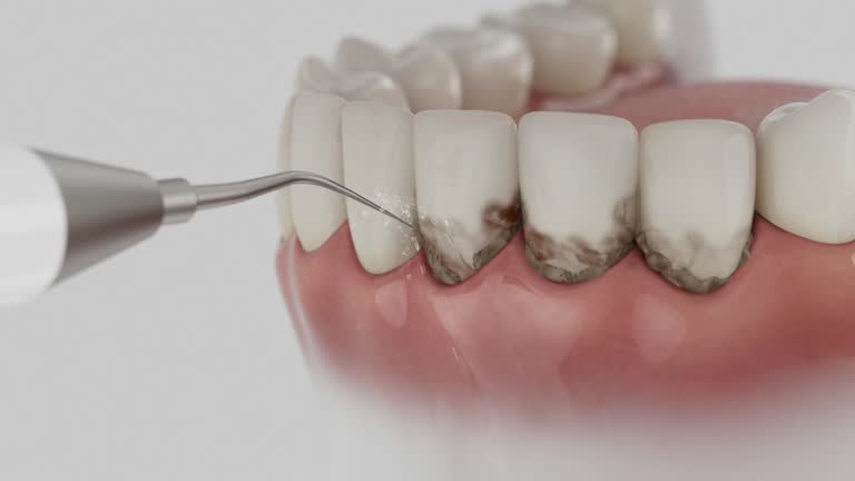 Reliable Dental Implants contractor in Harrison, NJ by Smile Center Dentistry